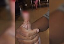 Mulher arranca parte do dedo polegar de policial com mordida durante abordagem mulher-arranca-parte-do-dedo-polegar-de-policial-com-mordida-durante-abordagem