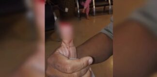 mulher-arranca-parte-do-dedo-polegar-de-policial-com-mordida-durante-abordagem