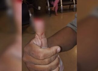 mulher-arranca-parte-do-dedo-polegar-de-policial-com-mordida-durante-abordagem