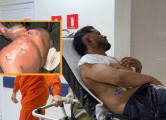 Mulher é presa após atear fogo no marido durante briga em Sorriso mulher-e-presa-apos-atear-fogo-no-marido-durante-briga-em-sorriso