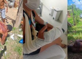Agressor que arrancou dedos da mulher com golpes de faca leva “salve” de facção e é preso agressor-que-arrancou-dedos-da-mulher-com-golpes-de-faca-leva-“salve”-de-faccao-e-e-preso